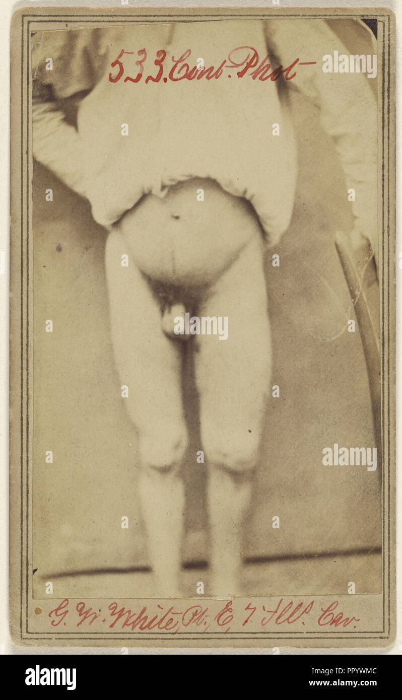 Geo. W. White Pri. Co. E. 7. Ill. Cav. age 25...Civil War victim; Attributed to William H. Bell, American, 1830 - 1910, April Stock Photo