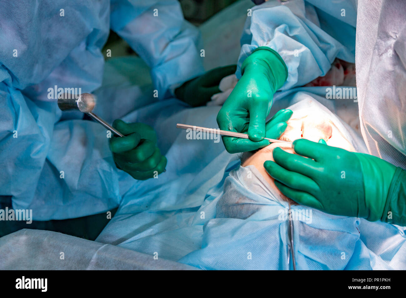 Surgeon and his assistant performing cosmetic surgery on nose in