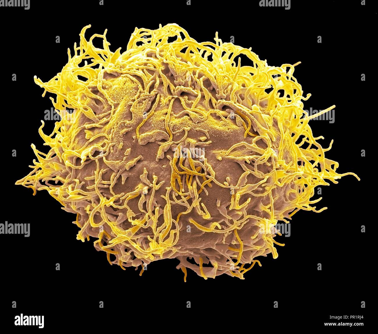 Mesenchymal stem cell. Coloured scanning electron micrograph (SEM) of a human mesenchymal stem cell (MSC). MSCs are multipotent stromal (connective tissue) cells that can differentiate into a variety of cell types, including osteoblasts (bone cells), chondrocytes (cartilage cells), and adipocytes (fat cells). The youngest, most primitive MSCs can be obtained from the umbilical cord tissue. Magnification: x3000 when printed 10 centimetres wide. Stock Photo