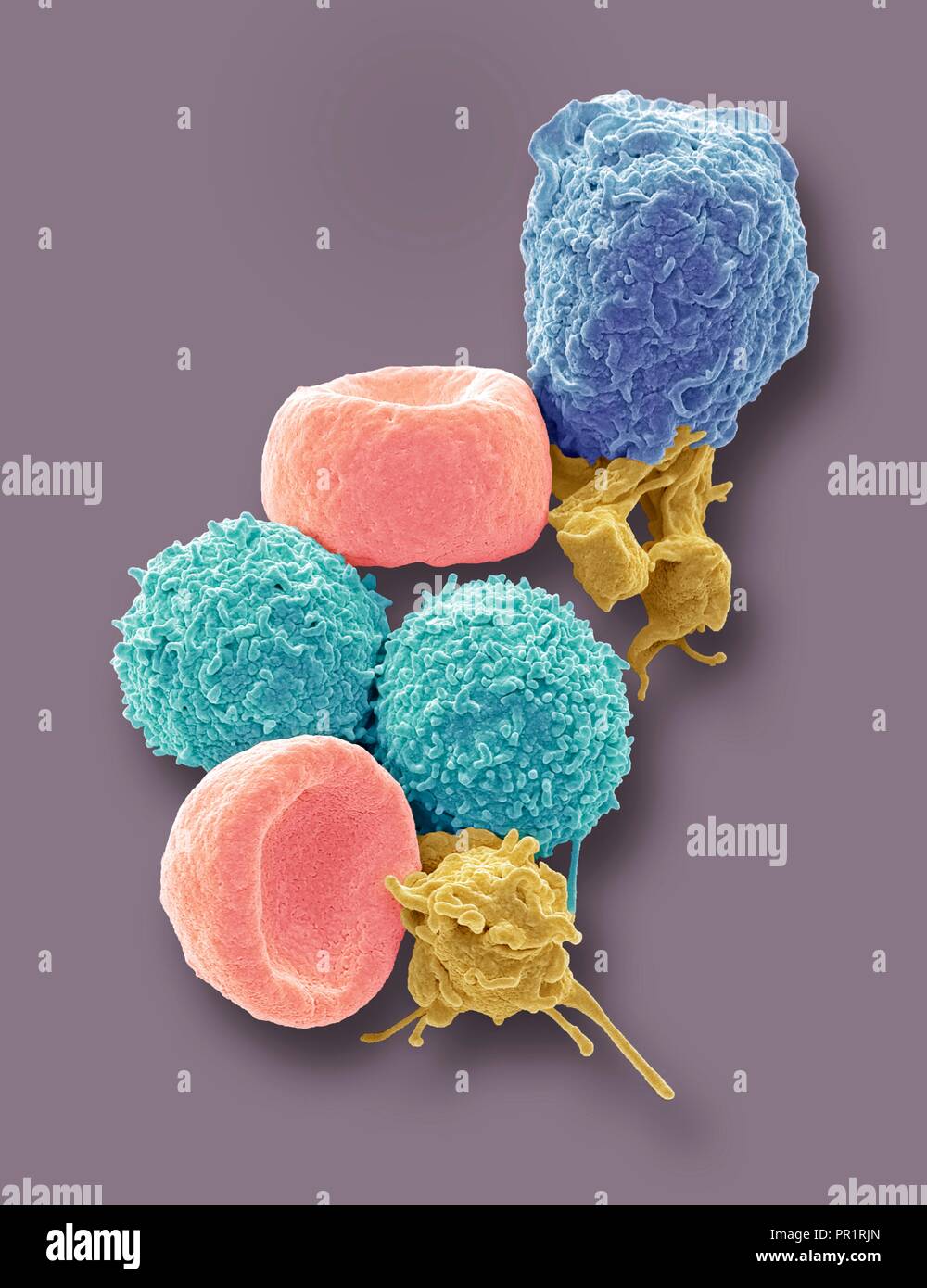 Blood cells. Coloured scanning electron micrograph (SEM) of human red blood cells (erythrocytes, red), white blood cells (leukocytes, blue and cyan), and platelets (thrombocytes, yellow). The disc-shaped, biconcave erythrocytes transport oxygen to the body's cells and remove carbon dioxide to the lungs. Leukocytes are part of the immune system, defending the body against infection by ingesting pathogens by phagocytosis or by producing antibodies. Magnification: x5000 when printed 10 centimetres high. Stock Photo
