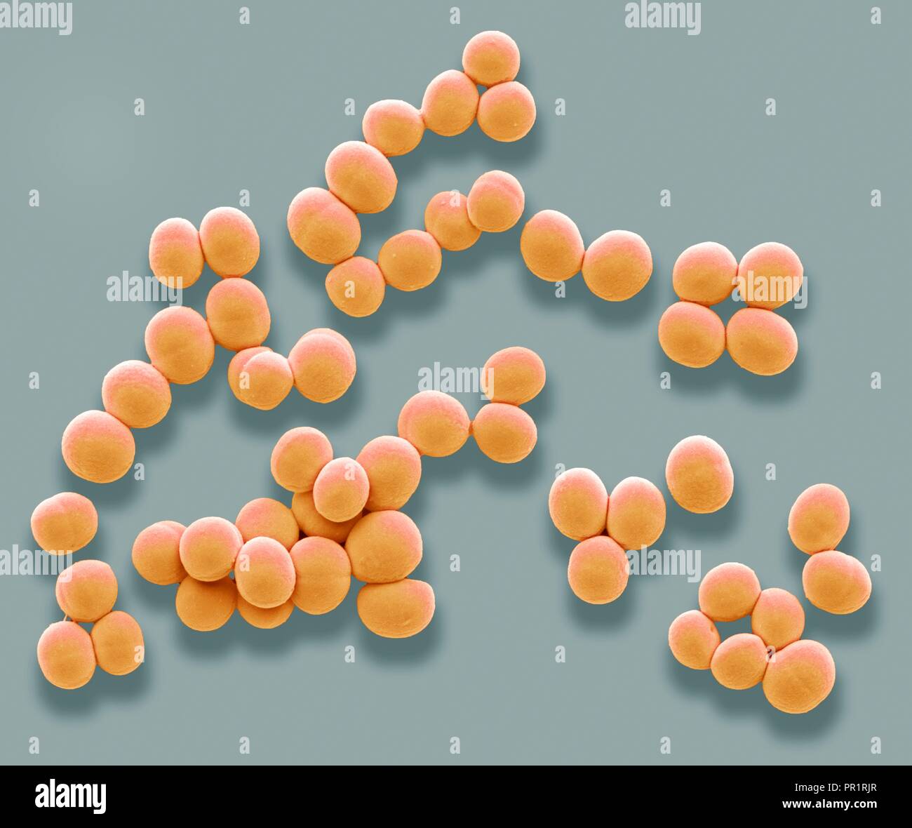 Staphylococcus aureus. Coloured scanning electron micrograph (SEM) of Staphylococcus aureus bacteria. These Gram-positive bacteria cause skin infections and often grow in these grape-like clusters of small spheres (cocci). S. aureus is extremely common in humans, living harmlessly on the skin and inside the nose, throat and large intestine. Treatment is with antibiotics if the infection is serious. Variants of S. aureus (MRSA) have developed resistance to many antibiotics. Magnification: x6000 when printed at 10 centimetres wide. Stock Photo