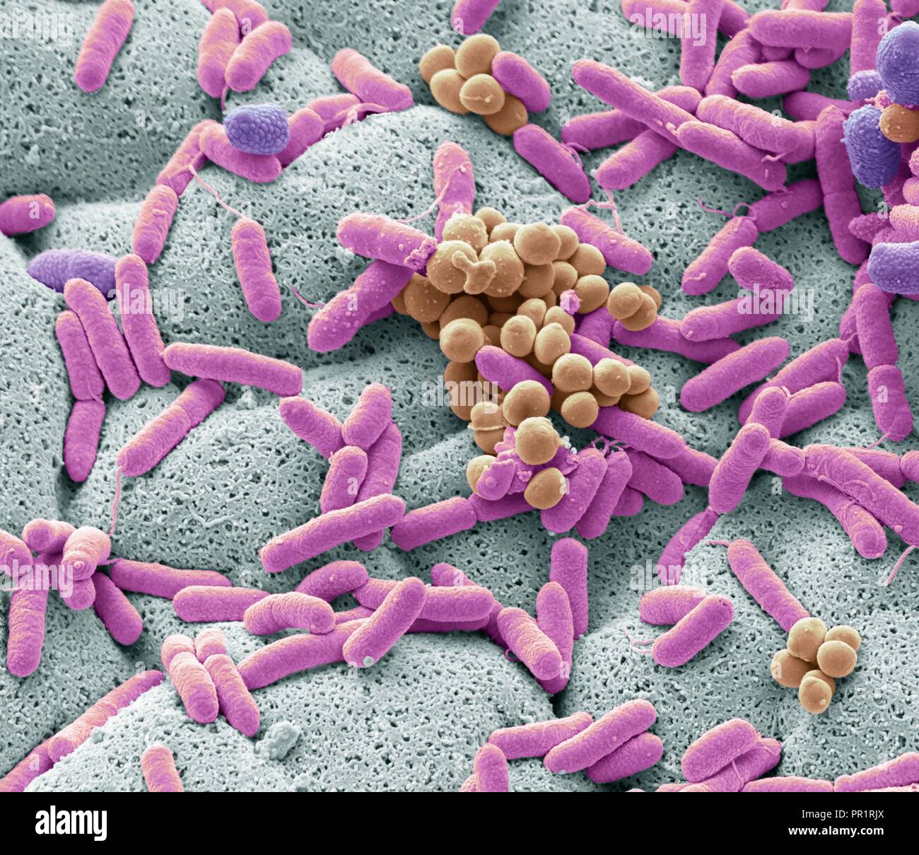 Salmonella bacteria dishcloth hires stock photography and images Alamy