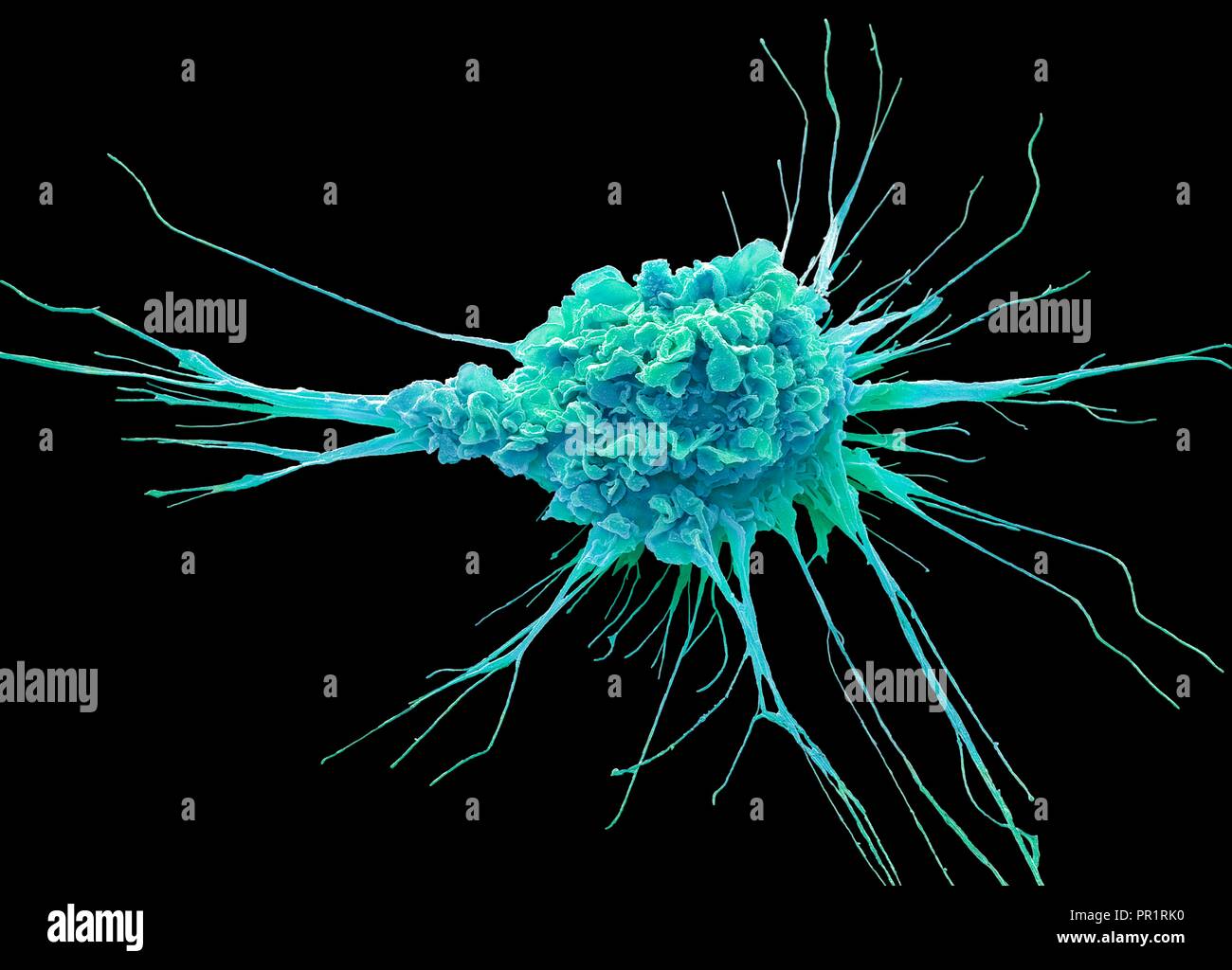 Dendritic cell. Coloured scanning electron micrograph (SEM) of a protective cell of the human immune system known as a dendritic cell. The long projections seen on the cell's surface are 'feet' to help it move. These cells process foreign antigens which then act like an alarm signal, alerting other immune cells of the body to the infection. Dendritic cells found in the upper layer of the skin (the epidermis) are known as histiocytes or Langerhans cells. In the central nervous system they are known as microglia, and in the liver as Kupffer cells. Magnification: x3000 when printed at 10cm wide. Stock Photo