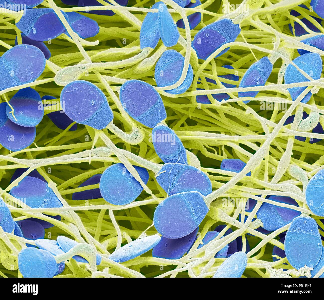 Pig sperm. Coloured scanning electron micrograph (SEM) of immature pig sperm from the epididymis. This immature sperm is characterised by a small amount of unshed residual cytoplasm below the head. The epididymis is a 7 metre long coiled tube that lies behind each testis, receiving sperm from them. The sperm mature as they pass slowly through this tube. Magnification: x4000 when printed at 10 centimetres wide. Stock Photo