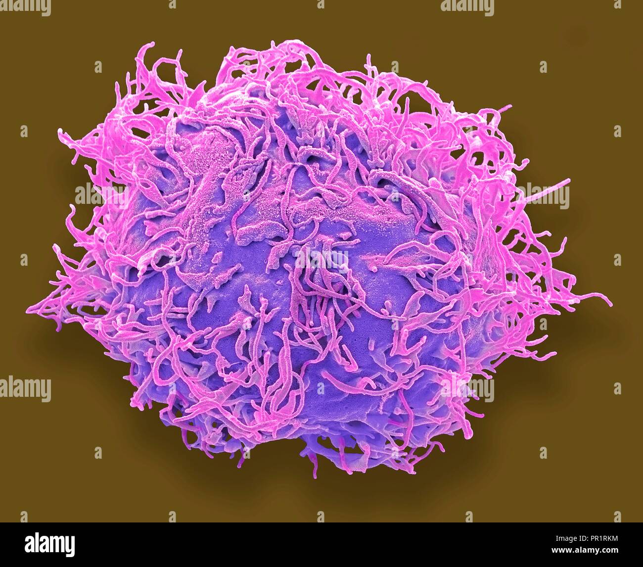 Mesenchymal stem cell. Coloured scanning electron micrograph (SEM) of a human mesenchymal stem cell (MSC). MSCs are multipotent stromal (connective tissue) cells that can differentiate into a variety of cell types, including osteoblasts (bone cells), chondrocytes (cartilage cells), and adipocytes (fat cells). The youngest, most primitive MSCs can be obtained from the umbilical cord tissue. Magnification: x3000 when printed 10 centimetres wide. Stock Photo