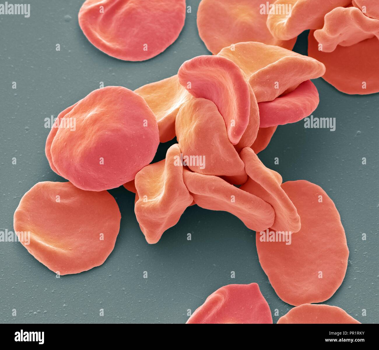 Coloured scanning electron micrograph (SEM) of red blood cells (RBCs,  erythrocytes). Red blood cells are biconcave, disc-shaped cells that  transport oxygen from the lungs to body cells. They circulate in the blood