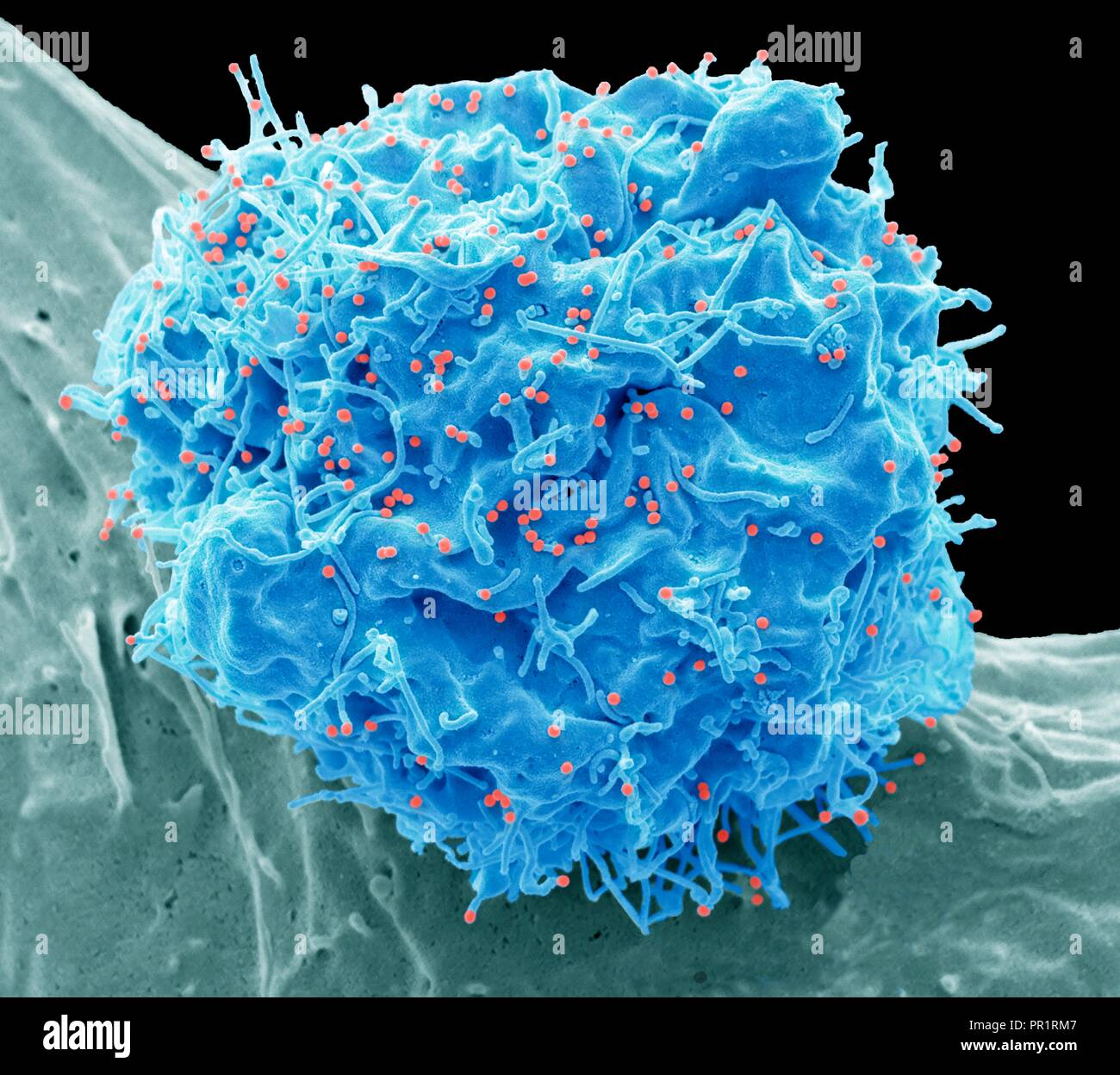 electron microscopy hiv