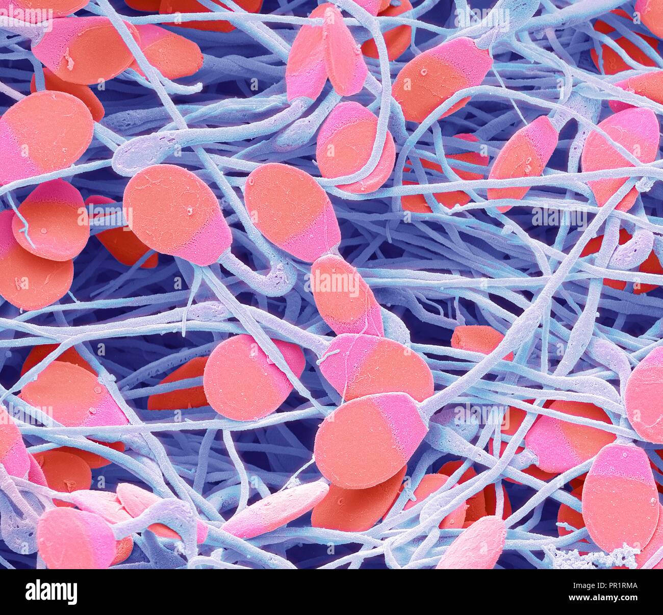 Pig sperm. Coloured scanning electron micrograph (SEM) of immature pig sperm from the epididymis. This immature sperm is characterised by a small amount of unshed residual cytoplasm below the head. The epididymis is a 7 metre long coiled tube that lies behind each testis, receiving sperm from them. The sperm mature as they pass slowly through this tube. Magnification: x4000 when printed at 10 centimetres wide. Stock Photo