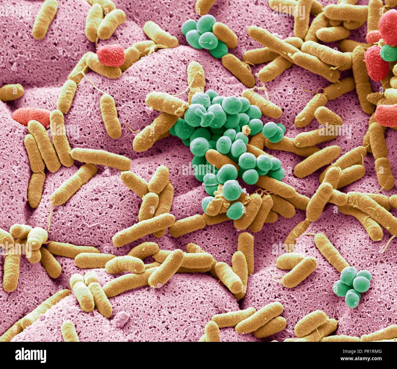 Coloured scanning electron micrograph (SEM) of bacteria cultured from a used dishcloth. Dishcloths can have six times as many bacteria as toilet handles according to some studies. They often harbour harmful E. coli bacteria, which can cause diarrhoea that can be fatal in vulnerable people. Many people fail to clean their dishcloth at a high enough temperature to kill commonly present bacteria such as Campylobacter, Salmonella, Staphylococcus, E. coli, and Listeria. Magnification: x6500 when printed at 10cm wide. Stock Photo