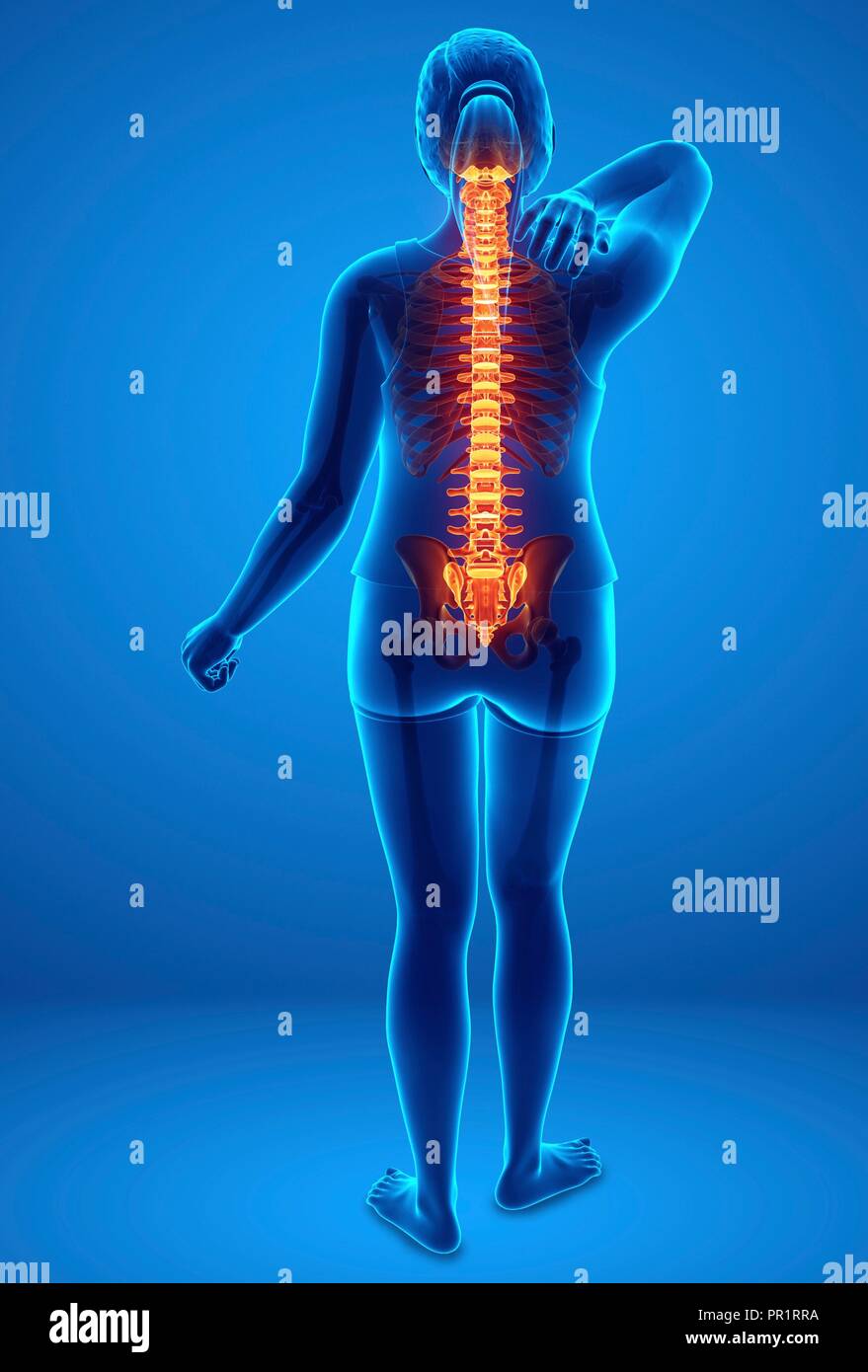 Back Problem Woman Diagram Woman with back pain, computer illustration Stock Photo - Alamy