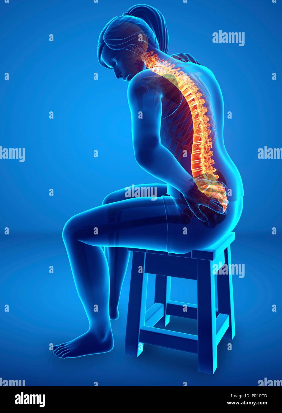 Is Back Pain From Computer? , Lower Back Pain When Sitting: Causes ...