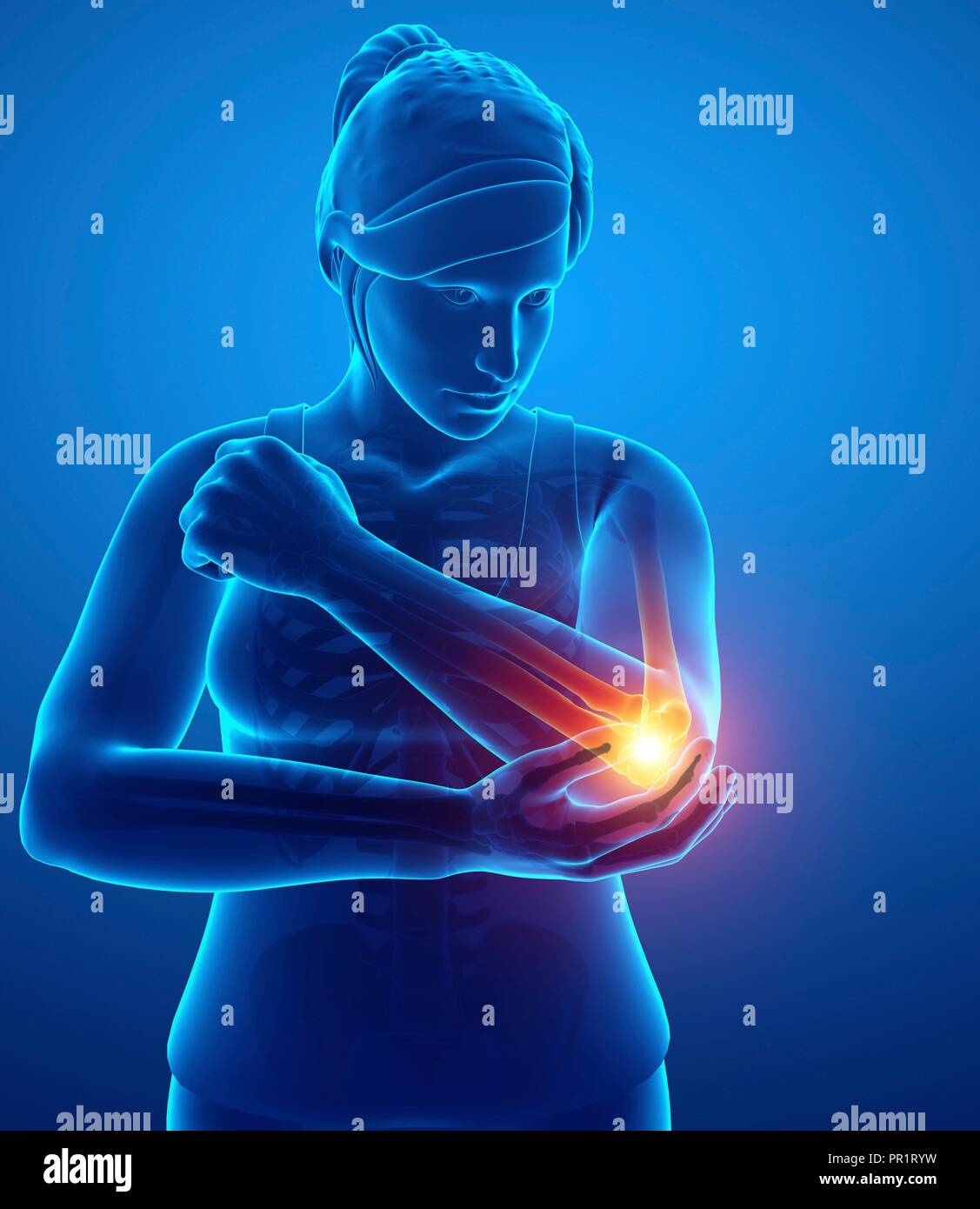 Woman with elbow pain, computer illustration Stock Photo Alamy