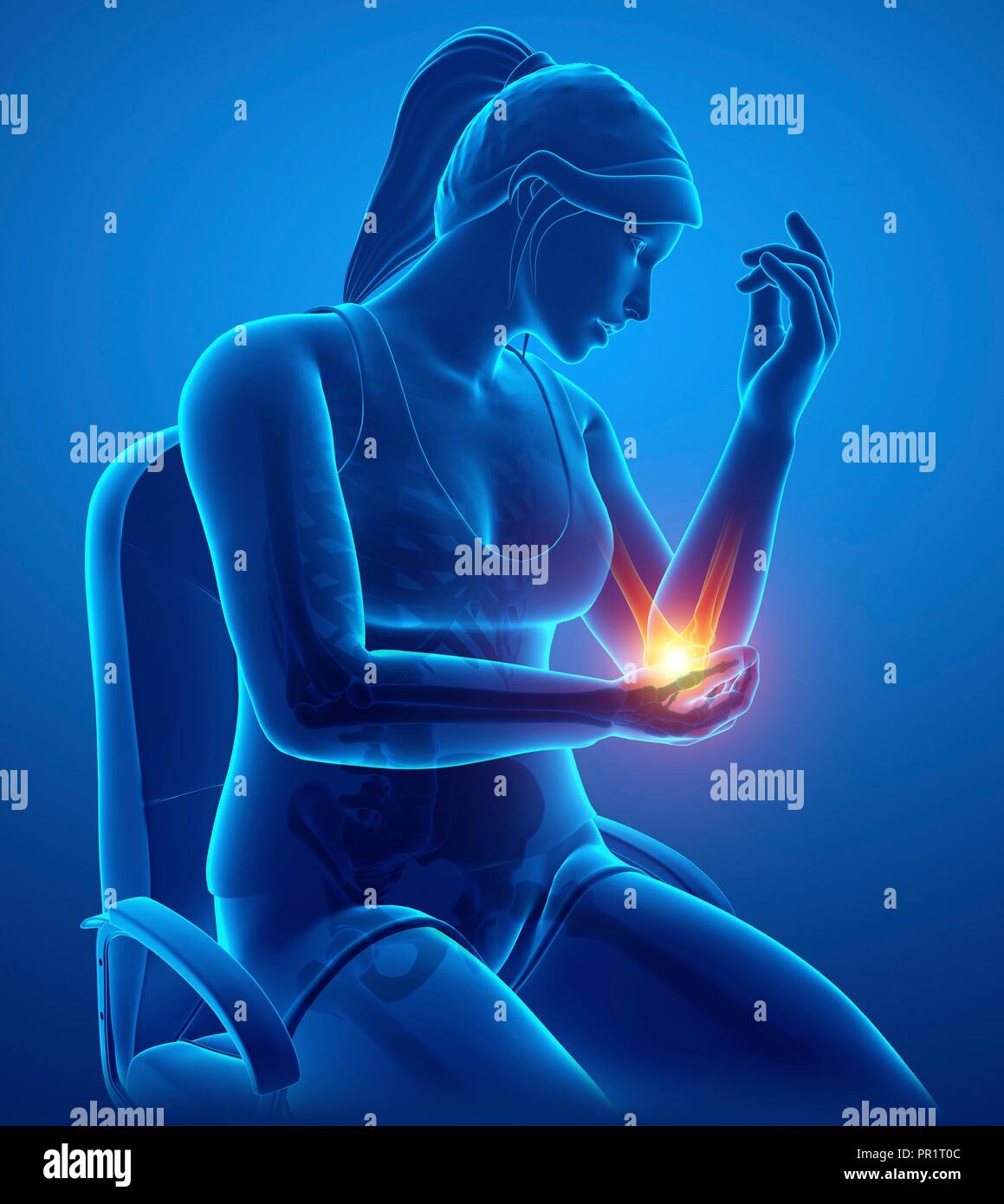 Woman with elbow pain, computer illustration Stock Photo Alamy