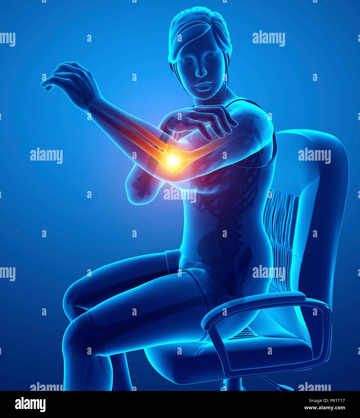 Woman with elbow pain, computer illustration Stock Photo Alamy
