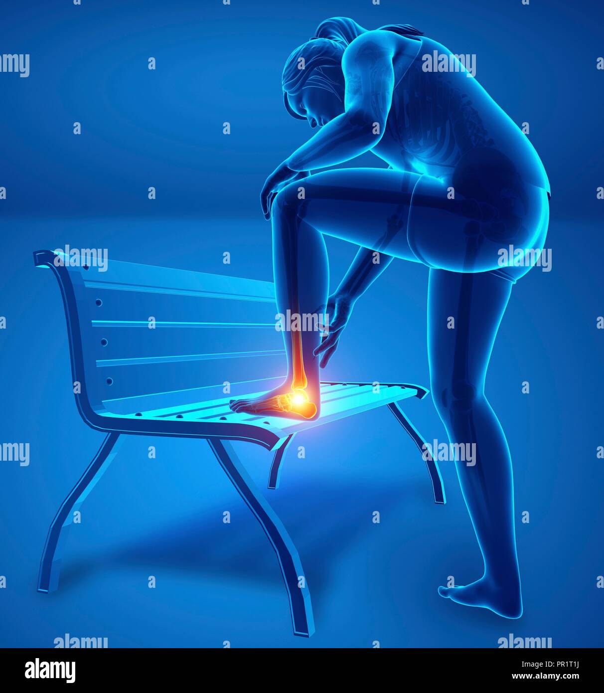 Woman with foot pain, computer illustration. Stock Photo