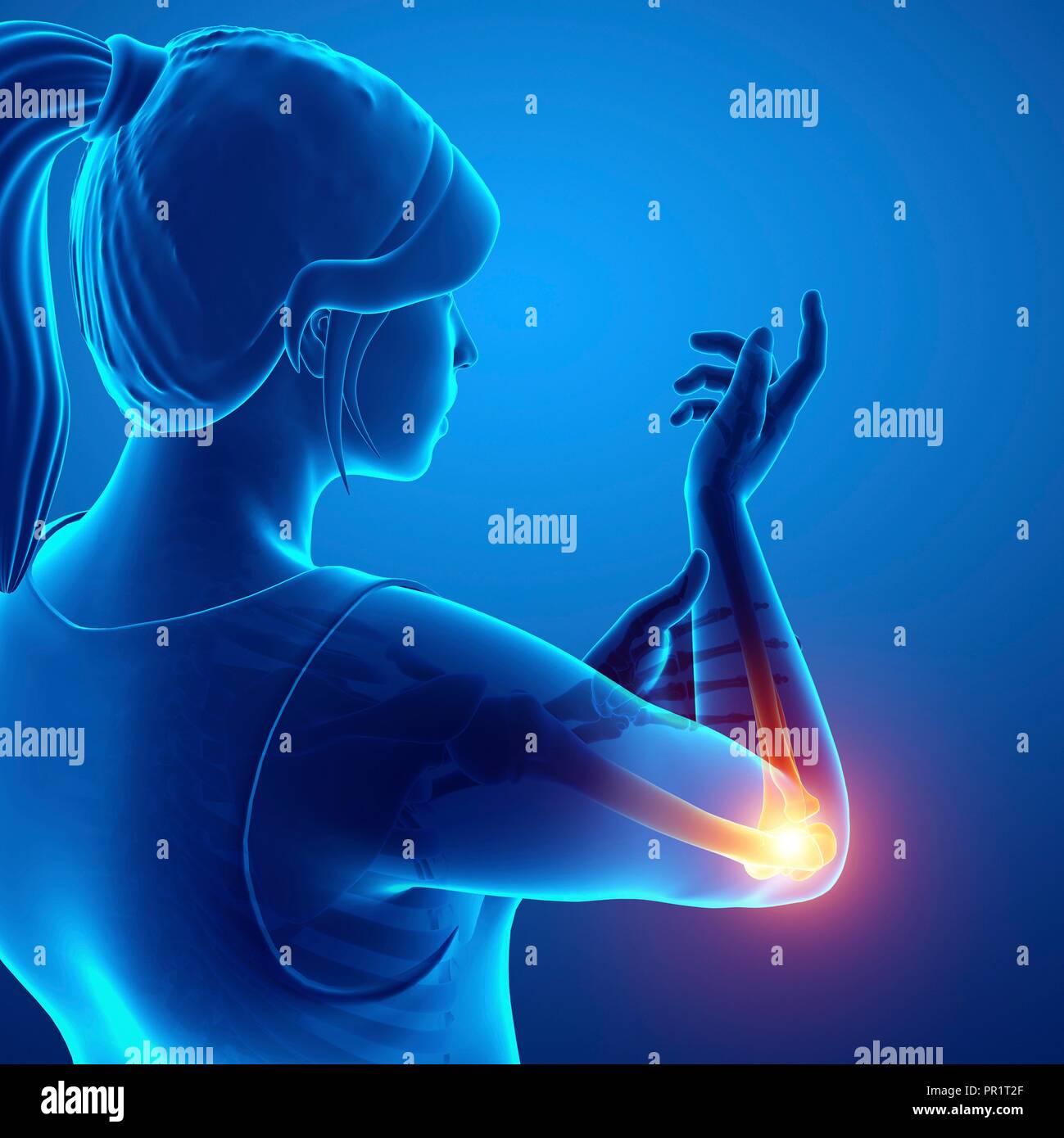 Woman with elbow pain, computer illustration Stock Photo Alamy