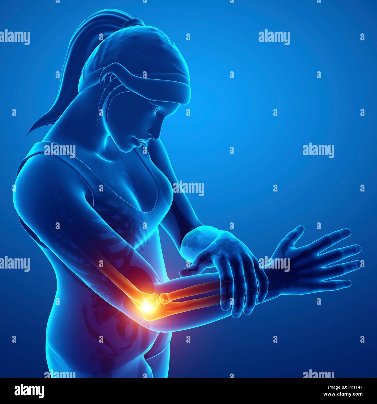 Woman with elbow pain, computer illustration Stock Photo Alamy
