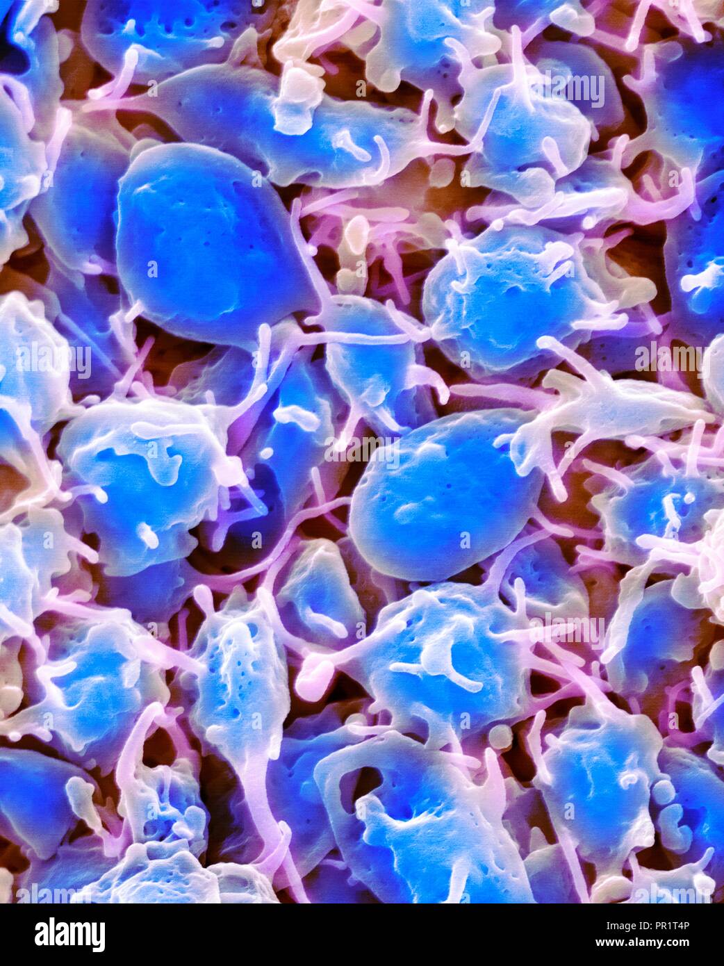 Activated platelets, coloured scanning electron micrograph (SEM). Platelets are blood cell fragments that play an essential role in blood clotting and wound repair, and can also activate certain immune responses. They are formed in the red bone marrow, lungs, and spleen by fragmentation of very large cells known as megakaryocytes. Platelets in the blood are small oval disks and are termed non-activated platelets or thrombocytes. They are the body's first line of defence against excessive blood loss. Magnification: x2,000 at 10 cm wide. Stock Photo