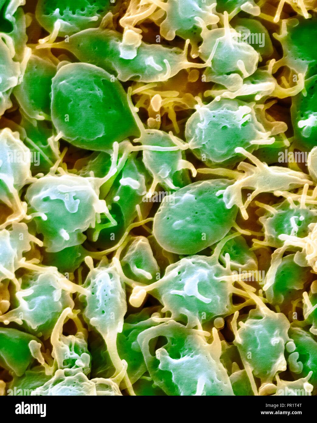 Activated platelets, coloured scanning electron micrograph (SEM). Platelets are blood cell fragments that play an essential role in blood clotting and wound repair, and can also activate certain immune responses. They are formed in the red bone marrow, lungs, and spleen by fragmentation of very large cells known as megakaryocytes. Platelets in the blood are small oval disks and are termed non-activated platelets or thrombocytes. They are the body's first line of defence against excessive blood loss. Magnification: x2,000 at 10 cm wide. Stock Photo