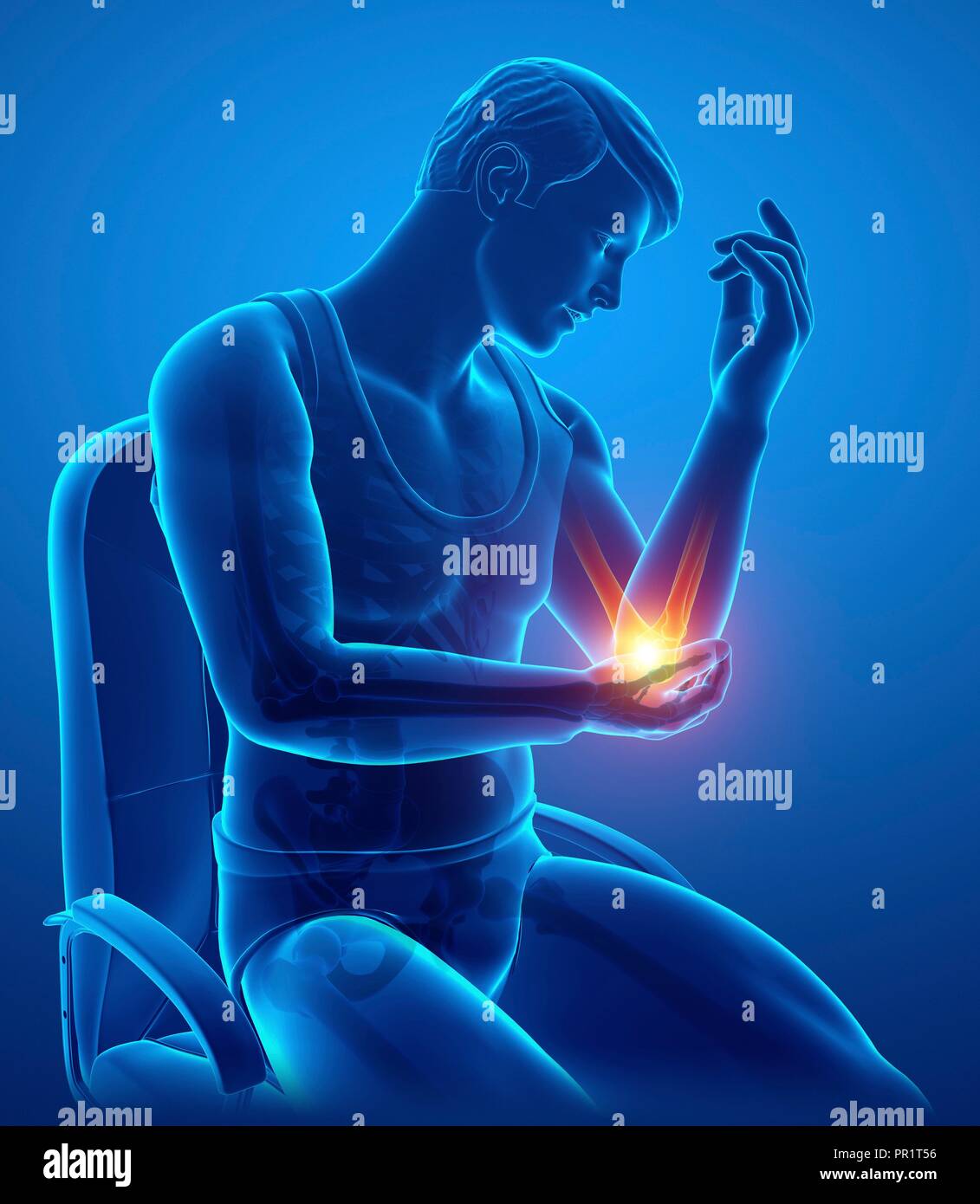 Man with elbow pain, computer illustration Stock Photo Alamy