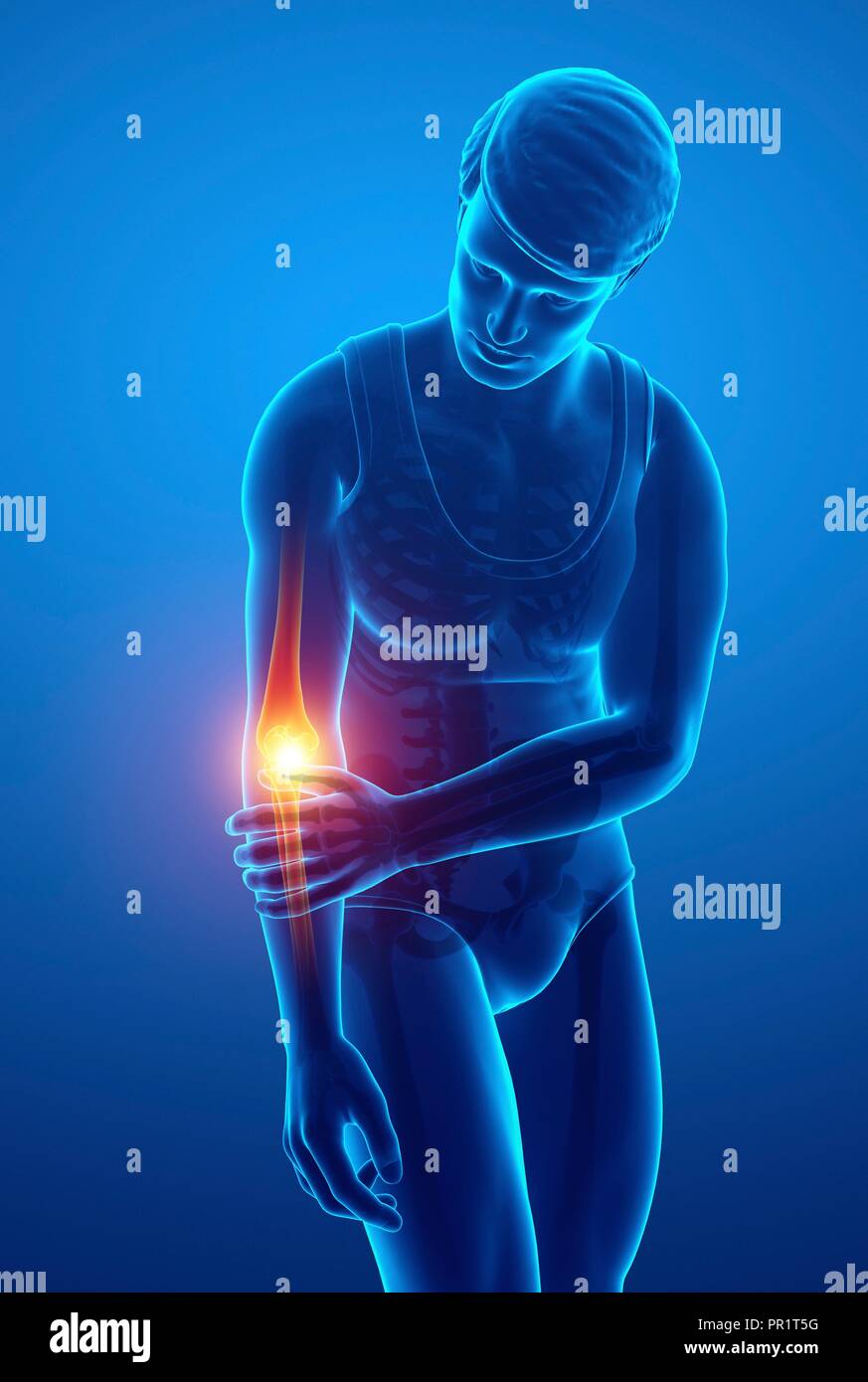 Man with elbow pain, computer illustration Stock Photo Alamy