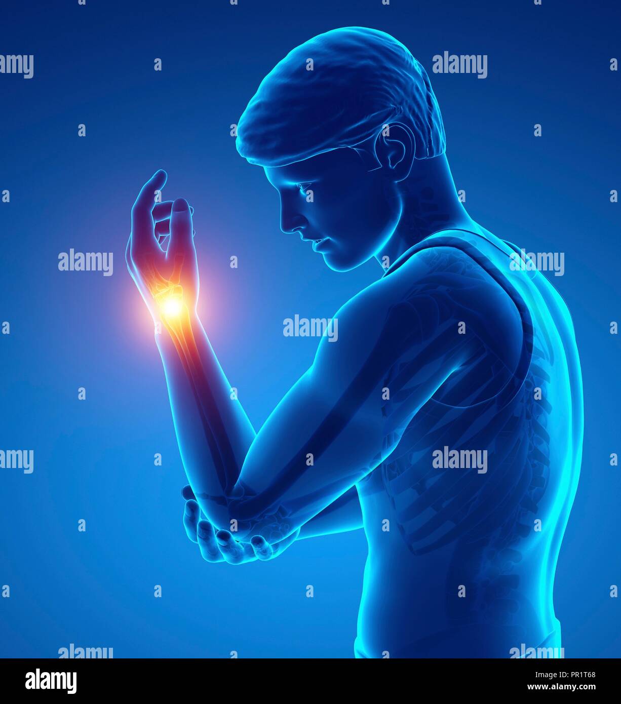 Man with wrist pain, computer illustration Stock Photo Alamy