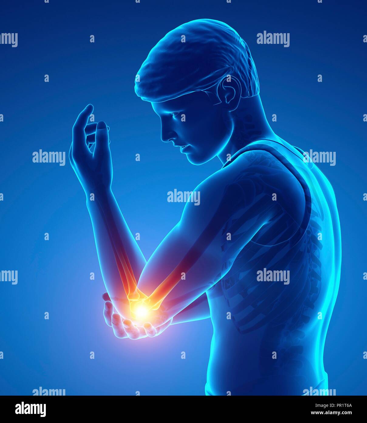 Man with elbow pain, computer illustration Stock Photo Alamy