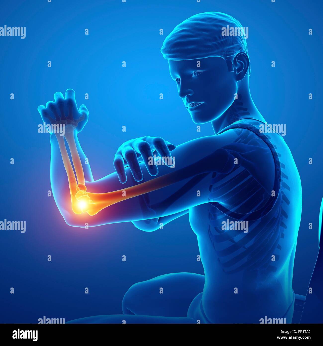 Man with elbow pain, computer illustration Stock Photo Alamy