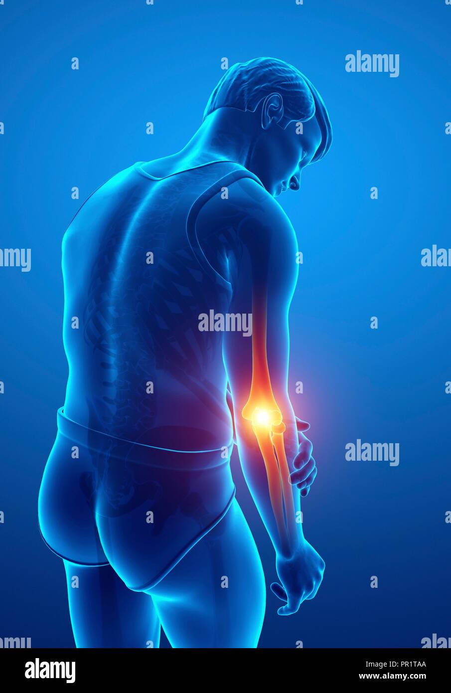 Man with elbow pain, computer illustration Stock Photo Alamy