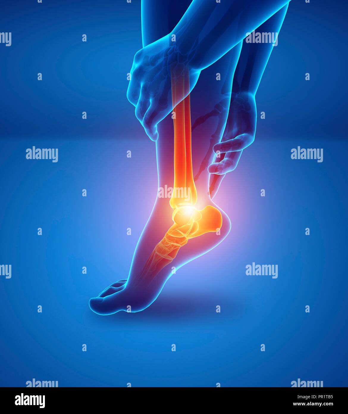 Man with foot pain, computer illustration. Stock Photo