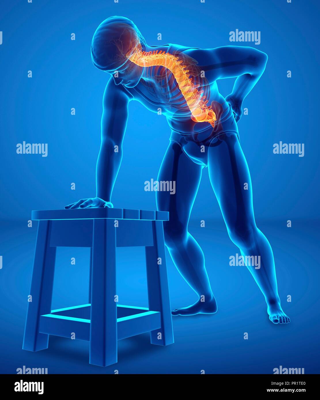 Man with back pain, computer illustration Stock Photo - Alamy