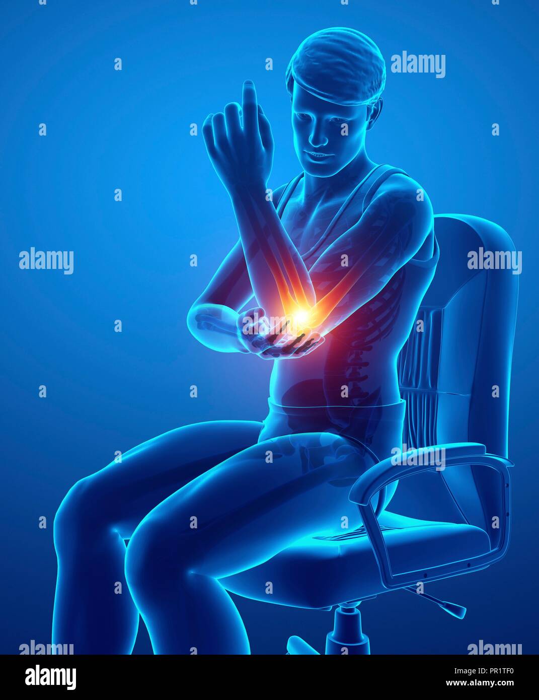 Man with elbow pain, computer illustration Stock Photo Alamy
