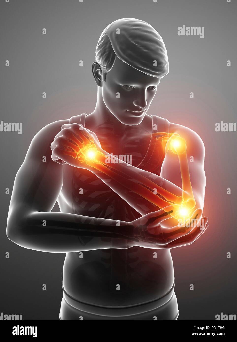 Man with arm pain, computer illustration Stock Photo Alamy