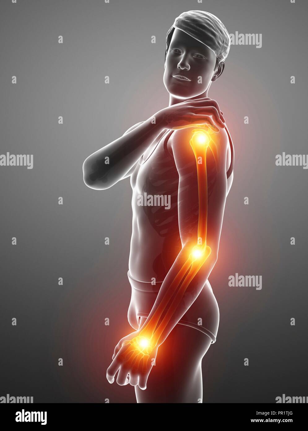Man with arm pain, computer illustration Stock Photo Alamy