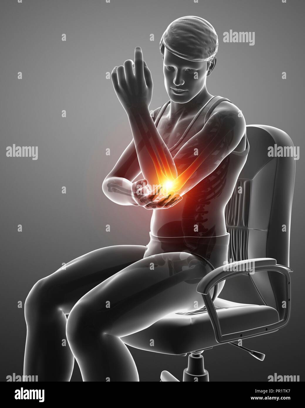 Man with elbow pain, computer illustration Stock Photo Alamy