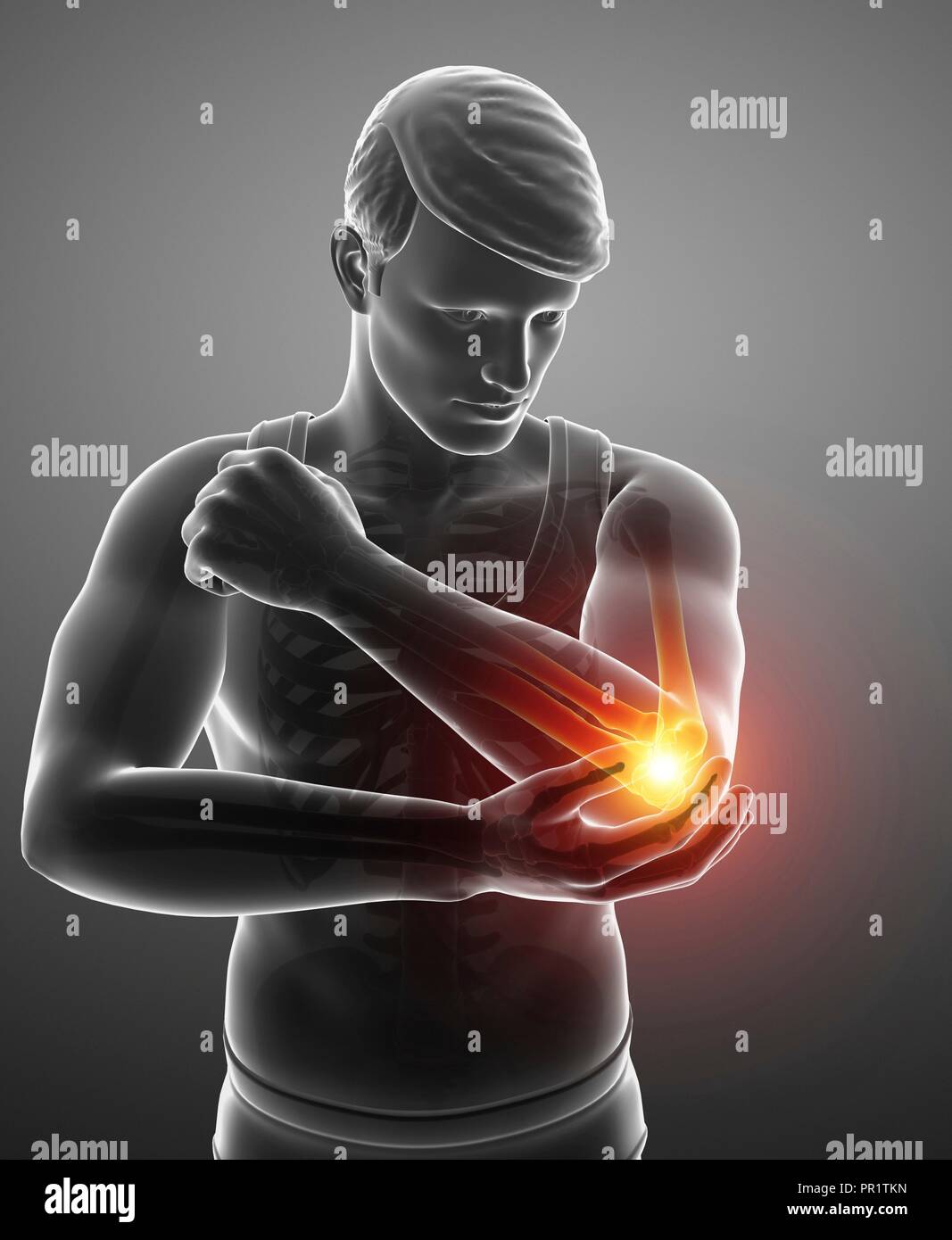Man with elbow pain, computer illustration Stock Photo Alamy
