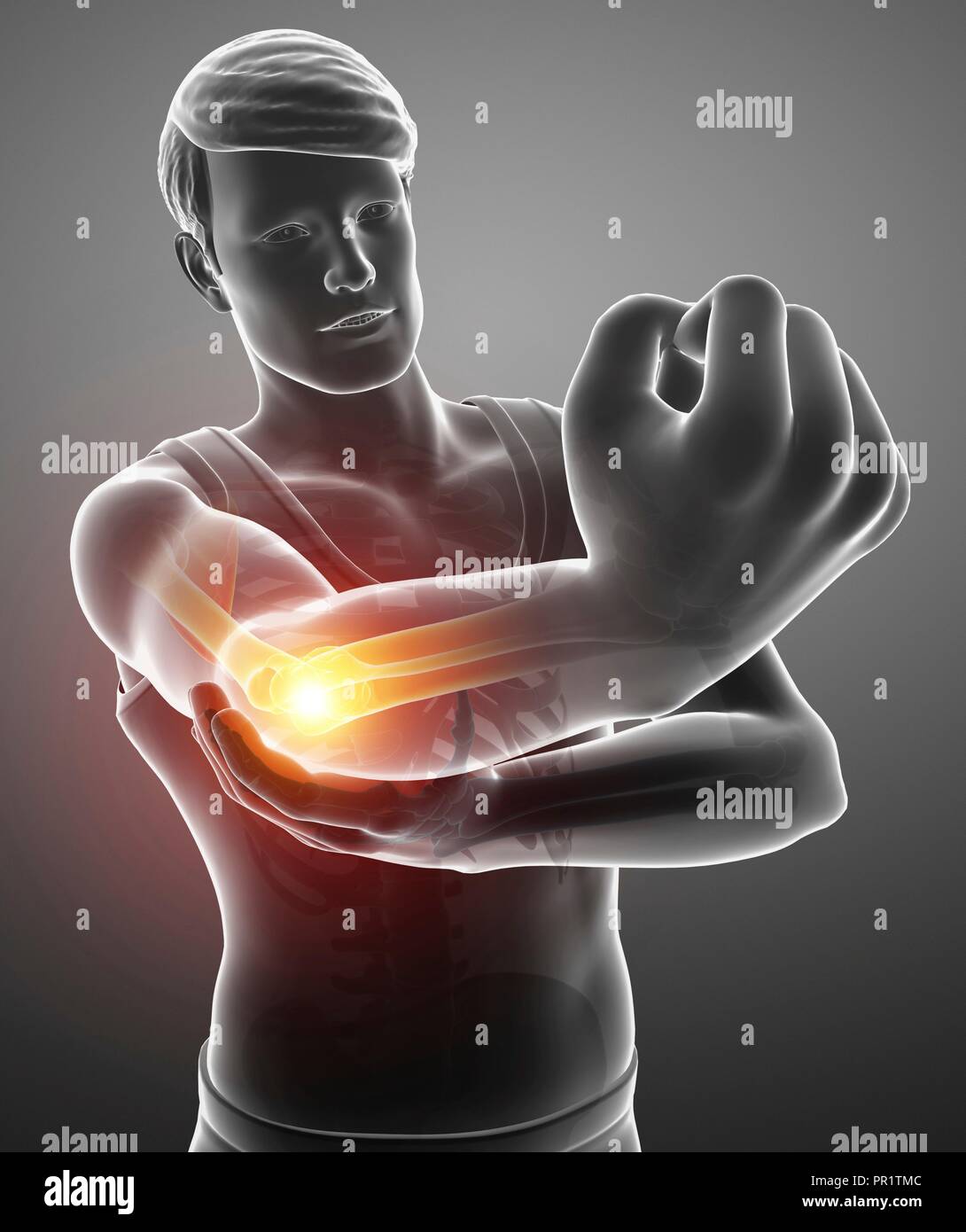 Man with elbow pain, computer illustration Stock Photo Alamy