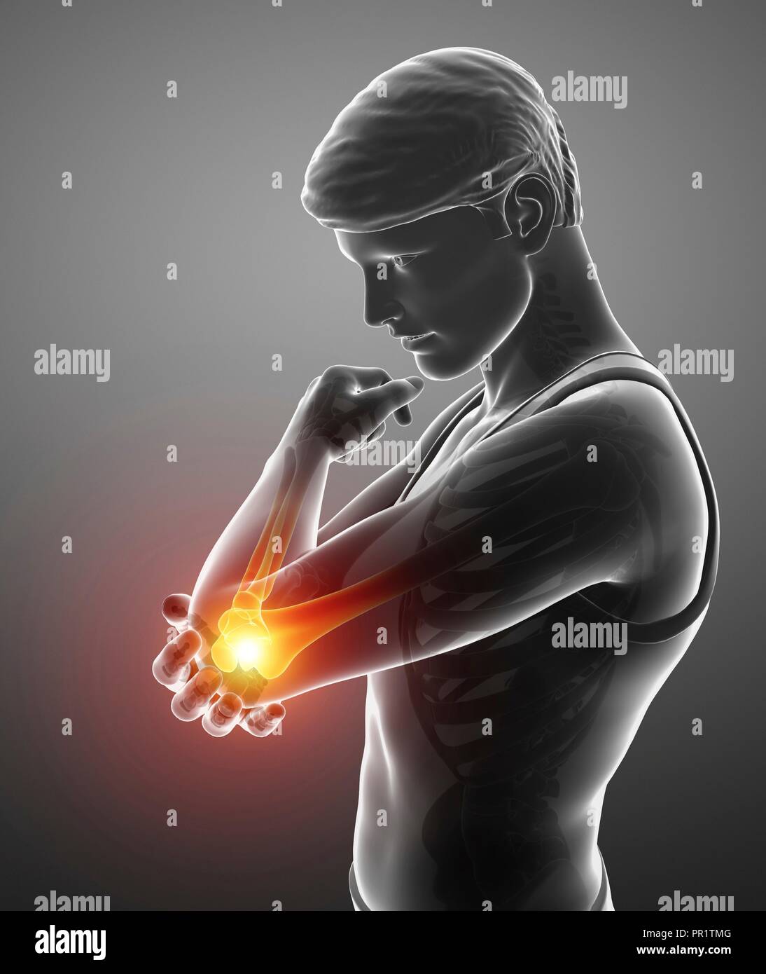 Man with elbow pain, computer illustration Stock Photo Alamy