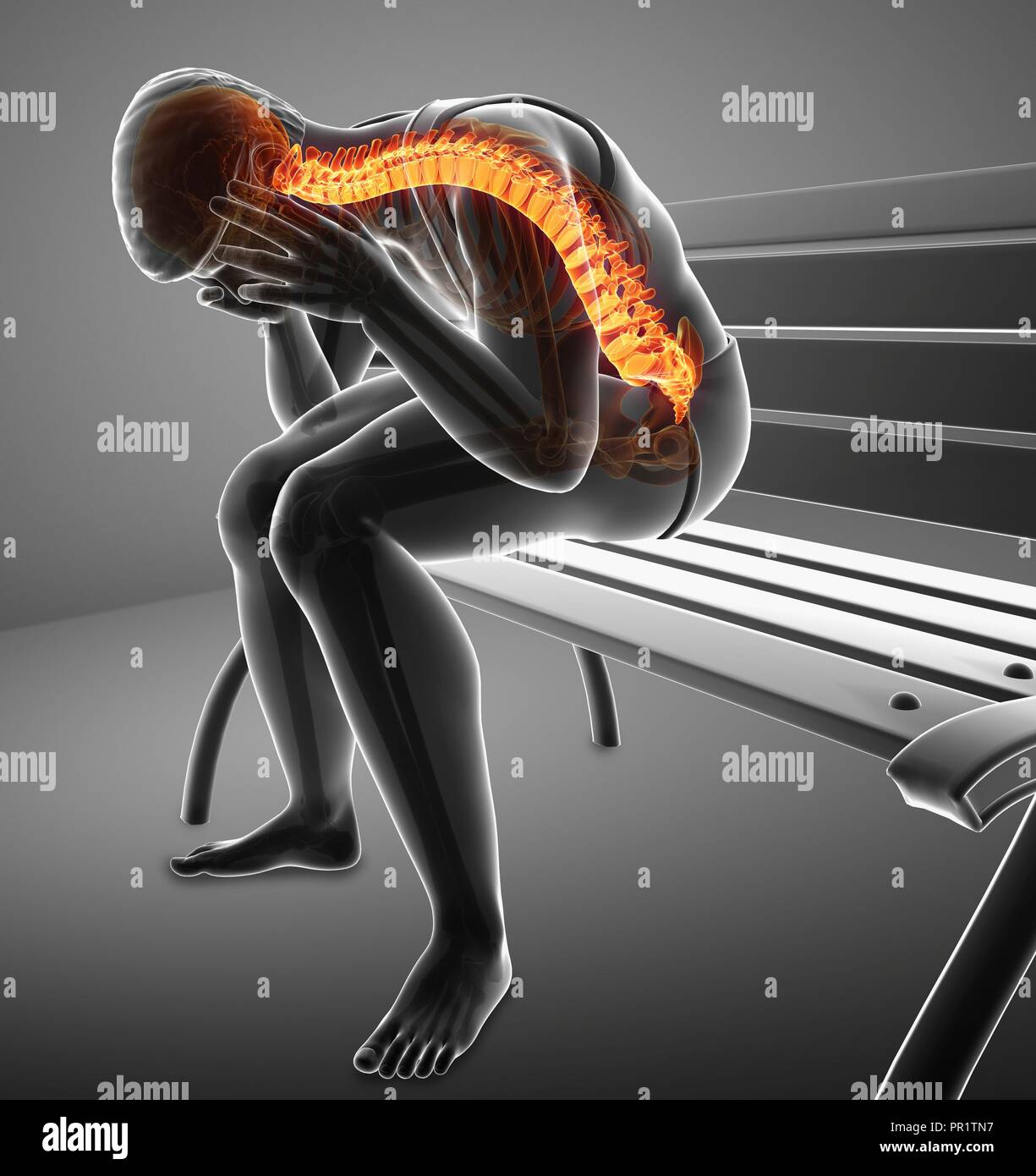 Man with back pain, computer illustration Stock Photo - Alamy