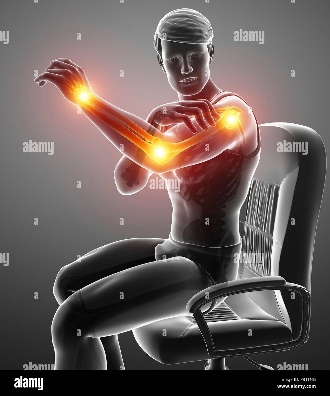 Man with arm pain, computer illustration Stock Photo Alamy