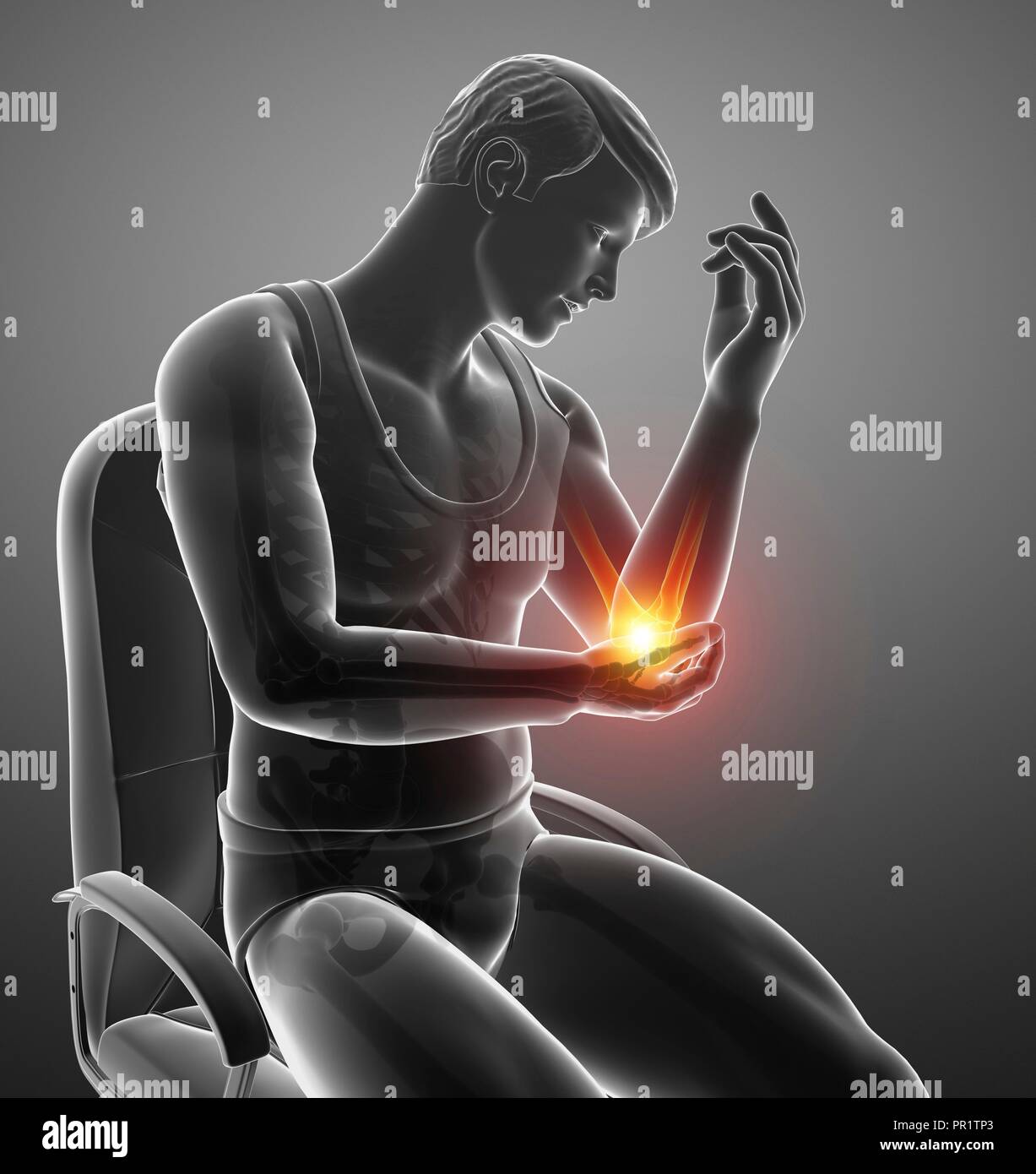 Man with elbow pain, computer illustration Stock Photo Alamy