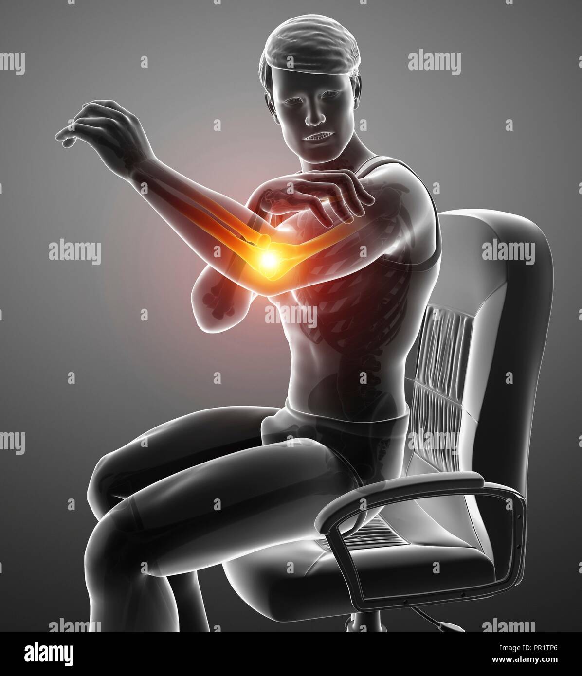 Man with elbow pain, computer illustration Stock Photo Alamy