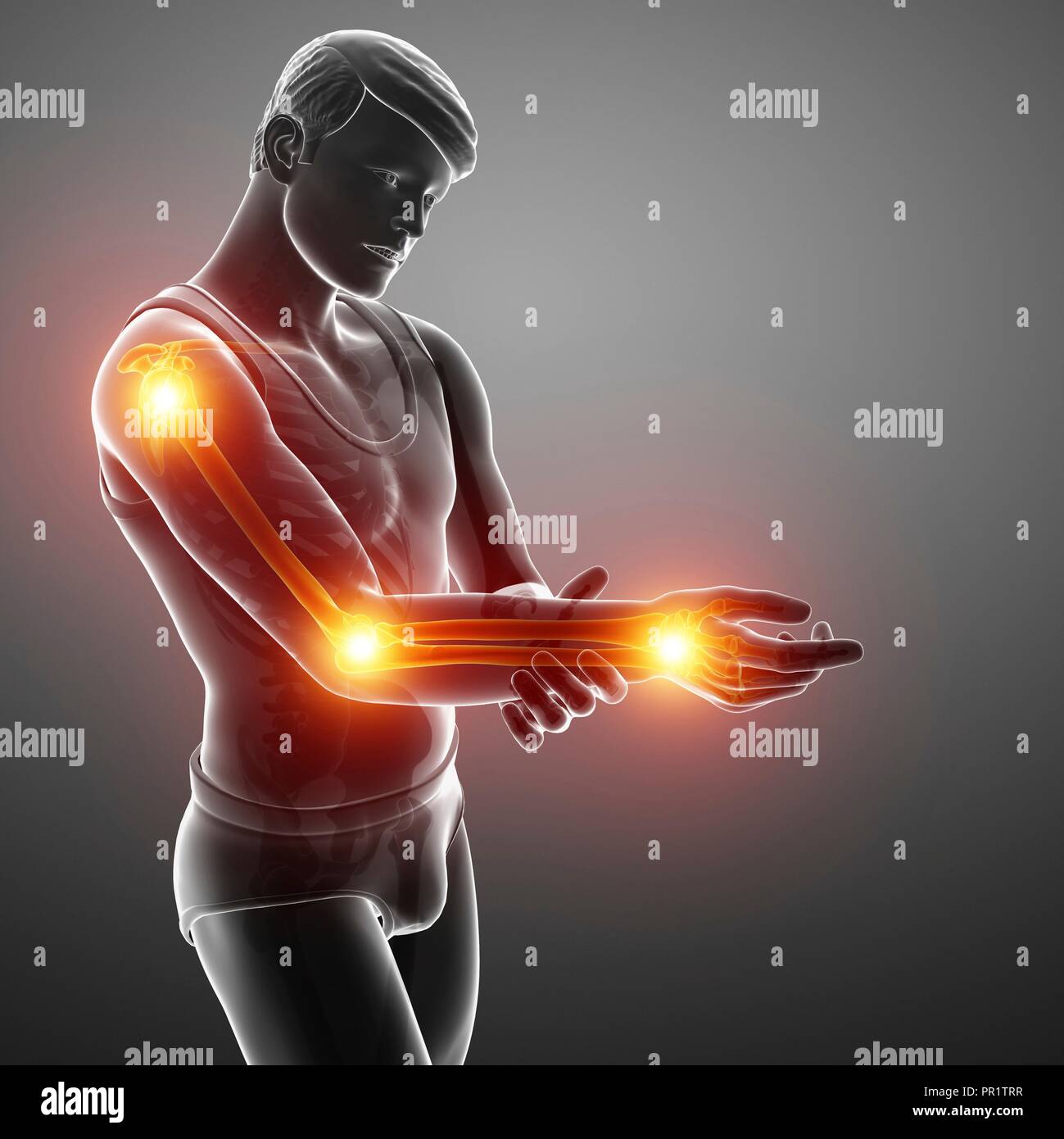 Man with arm pain, computer illustration Stock Photo Alamy