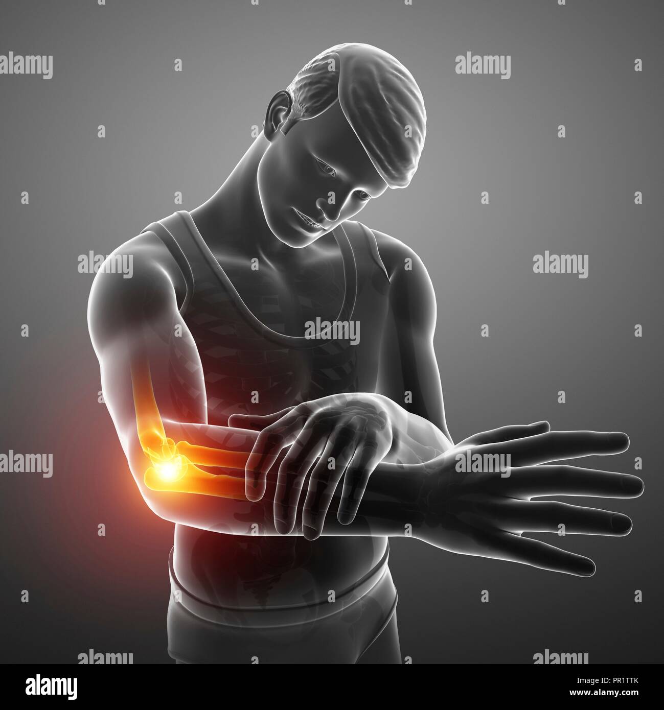 Man with elbow pain, computer illustration Stock Photo - Alamy