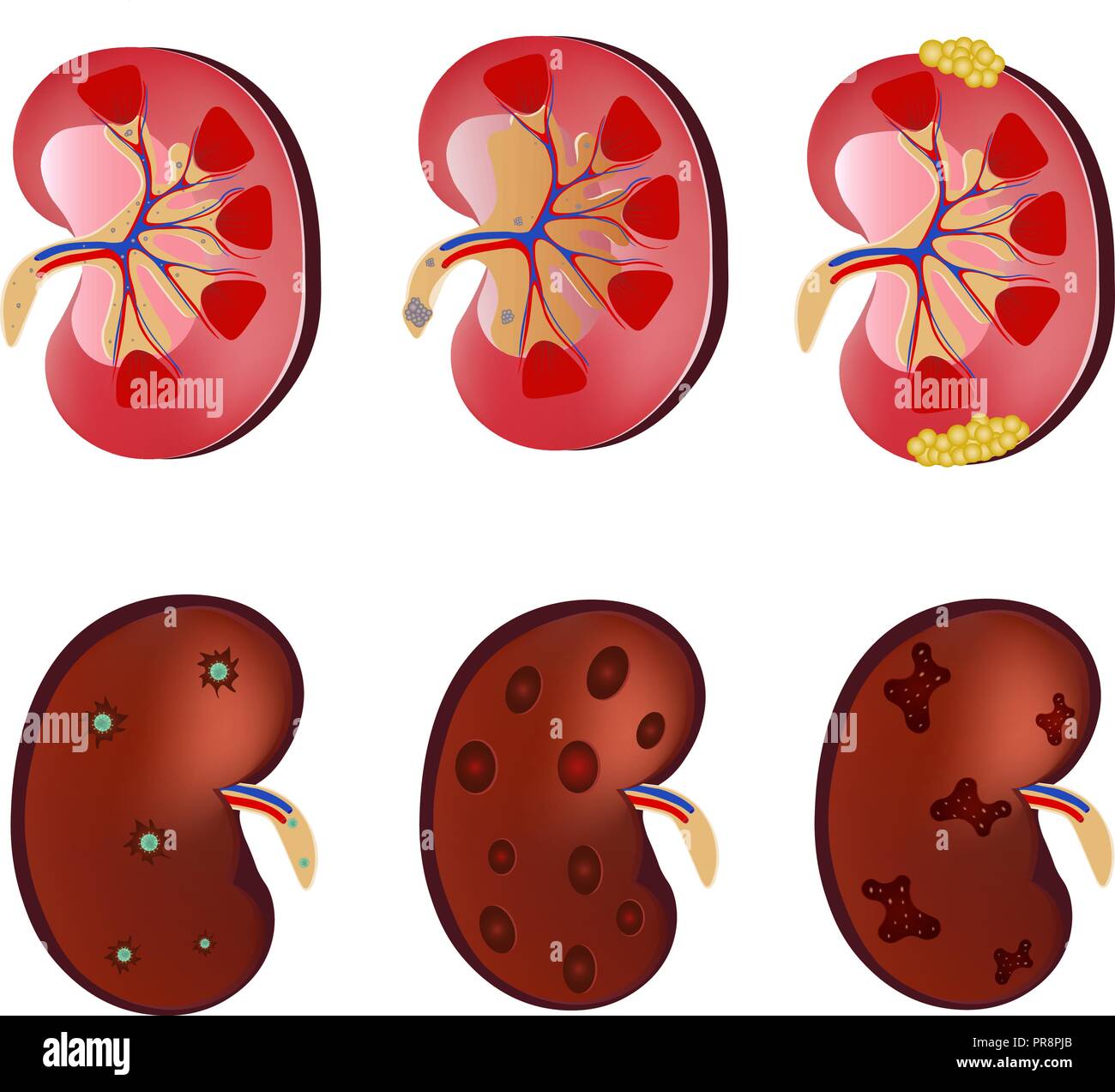 Various kidney diseases can for a long time not let know about