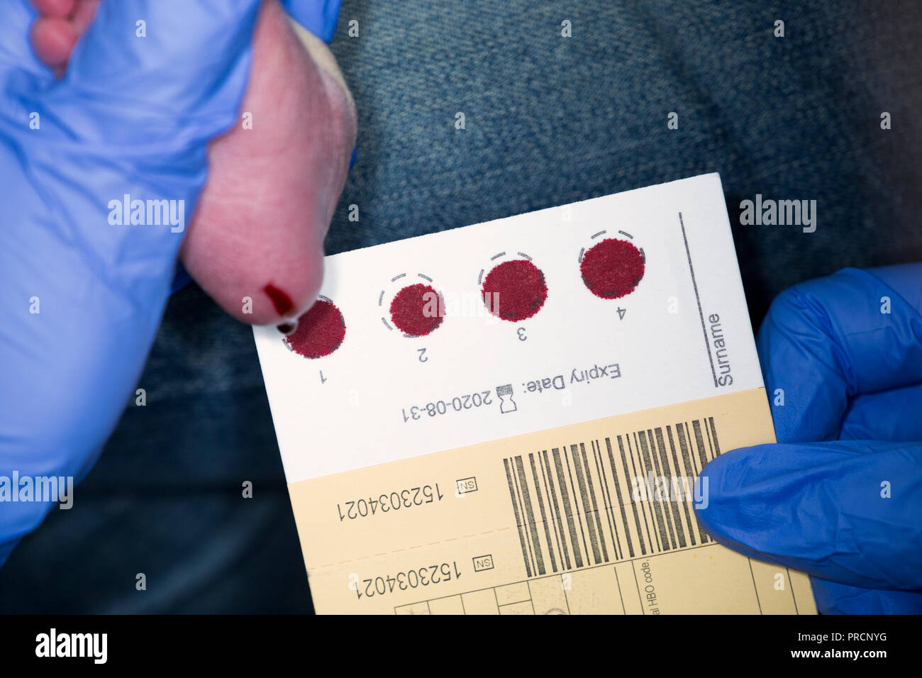 Newborn / new born baby undergoes neonatal heel prick screening ...