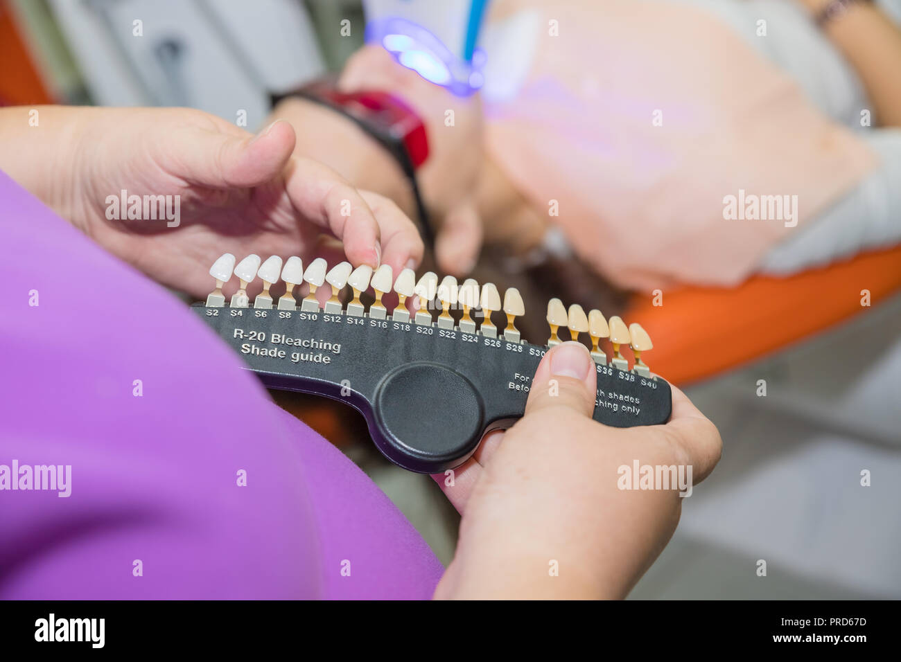 Testing whiteness of teeth of a patient.healthy teeth whitening. Dental