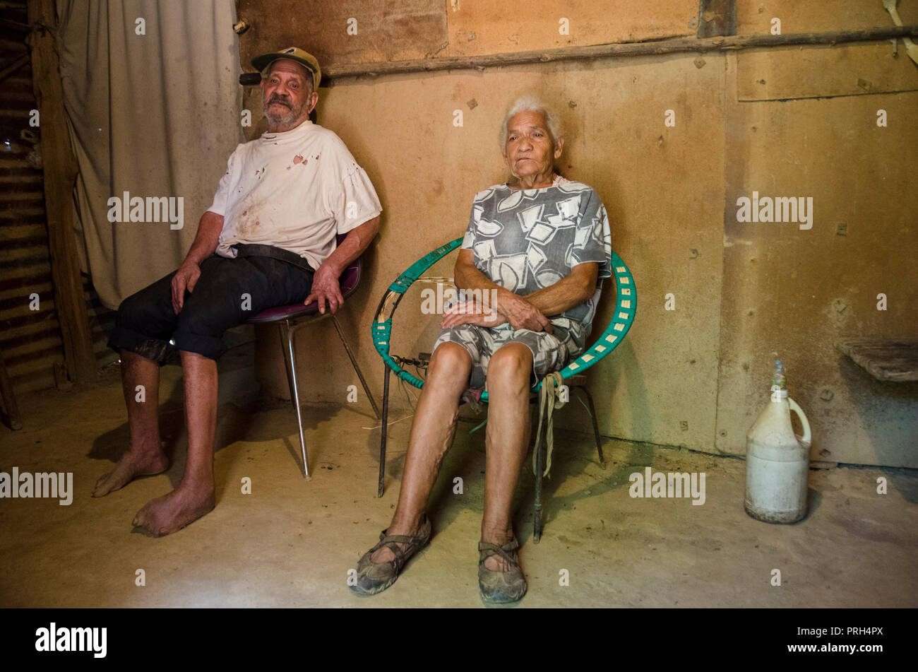Augusto and Edita Blanco are from very old brothers who live in El Paredon sector in Turgua, a rural area near Caracas. He has diabetes and has lost m Stock Photo