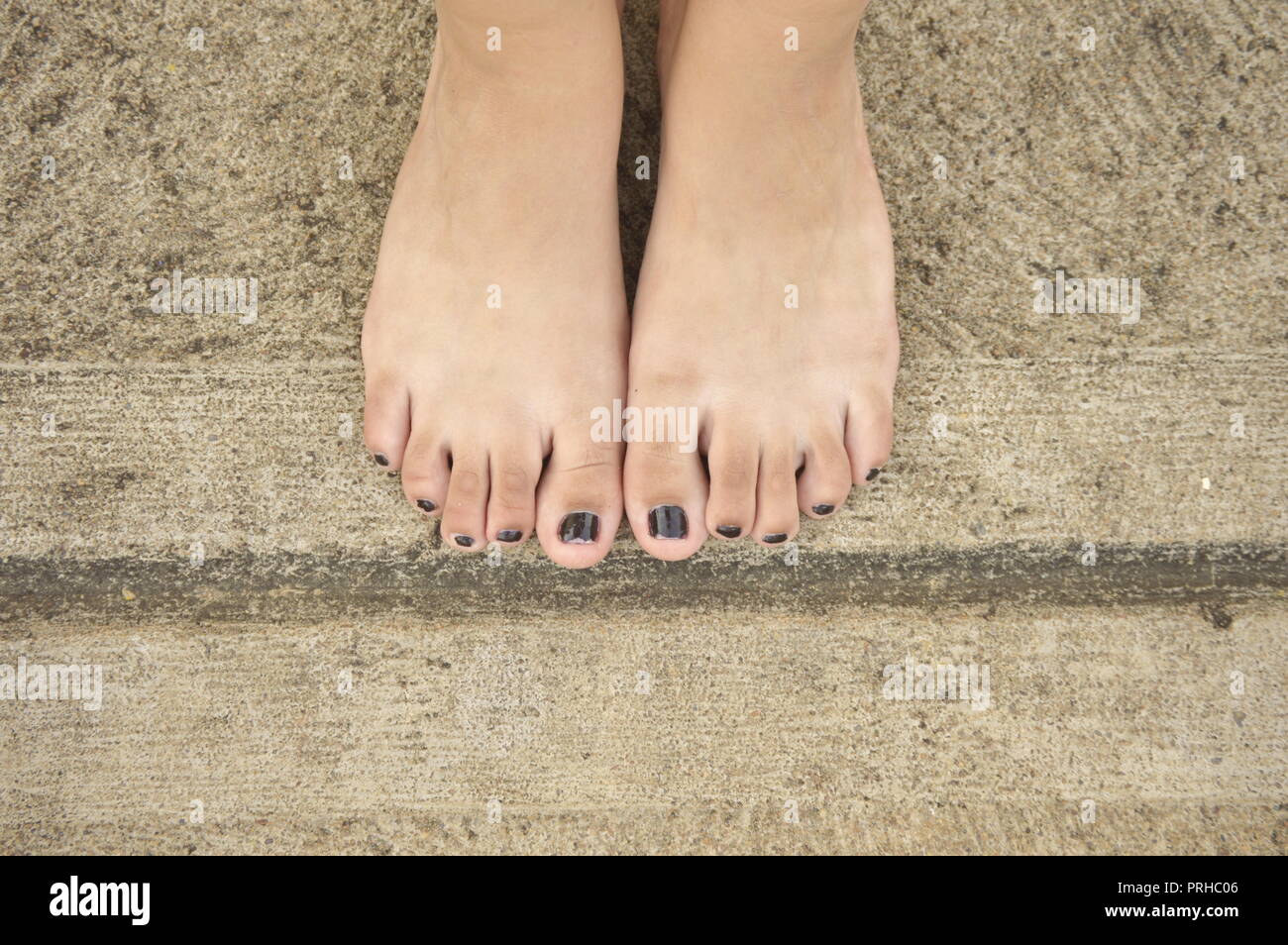 young woman feet with black nails Stock Photo Alamy