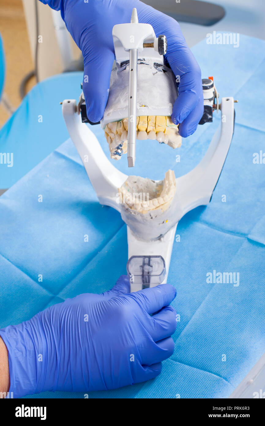 Dentist using dental articulator for a correct occlusion Stock Photo